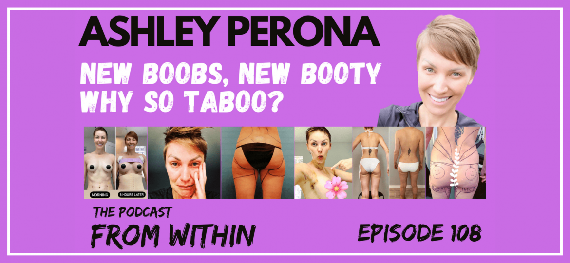 Podcast | New Boobs, New Booty…Why So Taboo?!